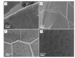 Ordered Mesoporous Carbon/Graphene/Nickel Foam for Flexible Dopamine Detection with Ultrahigh Sensitivity and Selectivity