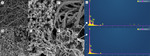 Preparations and Electrochemical Properties of BC/CoNi2S4@PPy Flexible Composites for Supercapacitors Figure 2