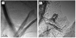 Preparations and Electrocatalytic Ethanol Properties of Palladium Intercalated Hydrotalcite Figure 3