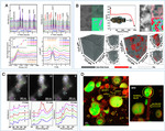 Synchrotron X-Rays Characterizations of Metal-Air Batteries