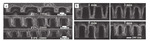 Research Progress in Electroless Cobalt Plating and the Bottom-up Filling of Electroless Plating Figure 7